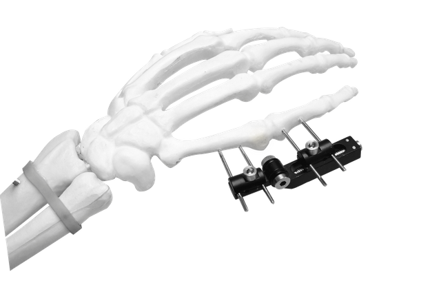 Mini Fijador Externo (Eje ​​Horizontal)