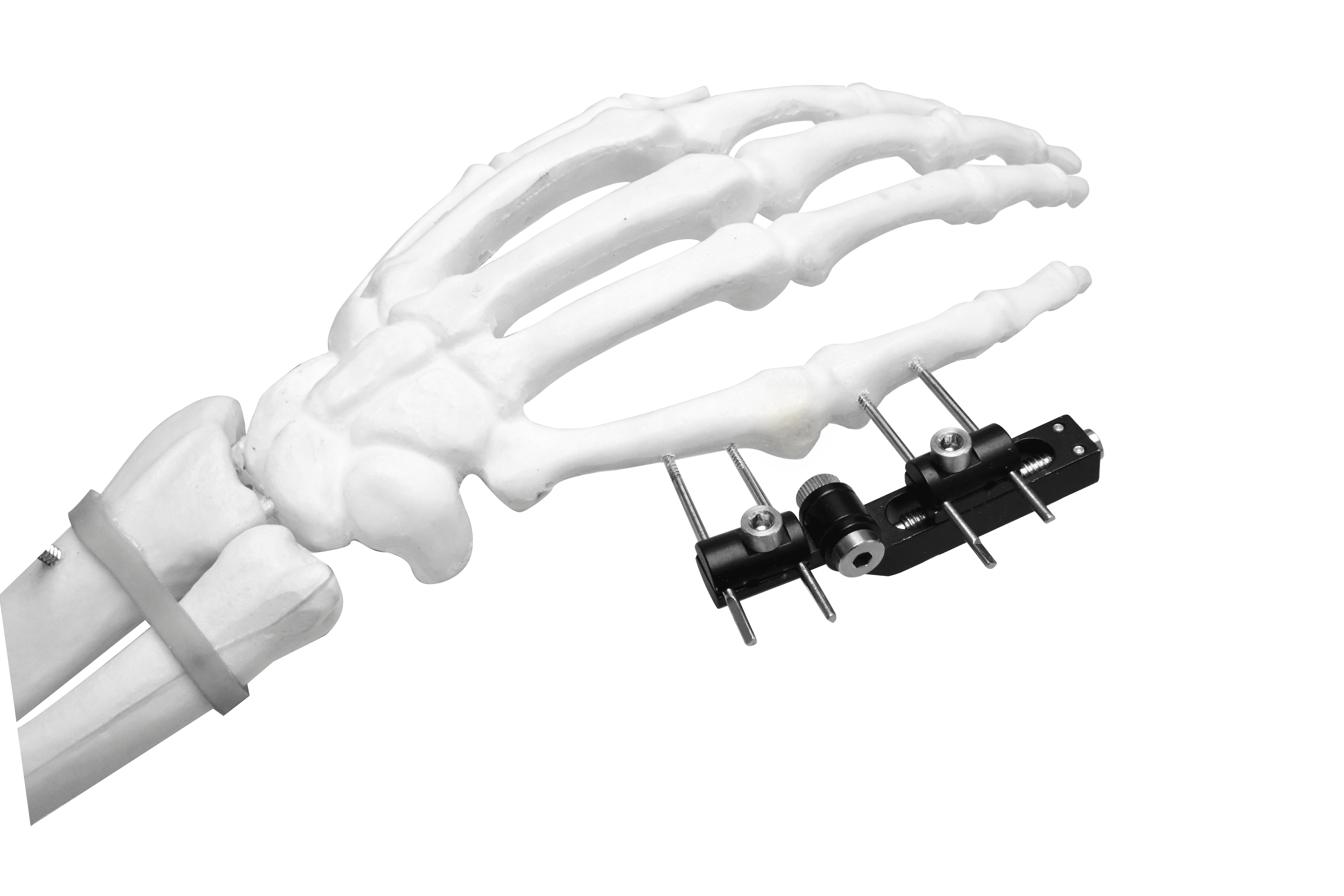 Mini Fijador Externo (Eje ​​Horizontal)
