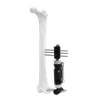 Fijador externo Micromotion de miembros inferiores (tipo T)