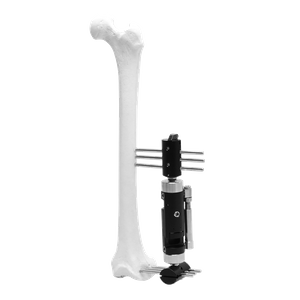 Fijador externo Micromotion de miembros inferiores (tipo T)