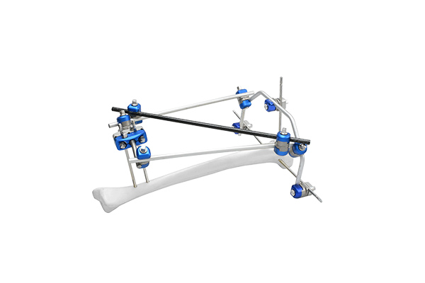 Fijador externo de tibia proximal Una solución ortopédica versátil