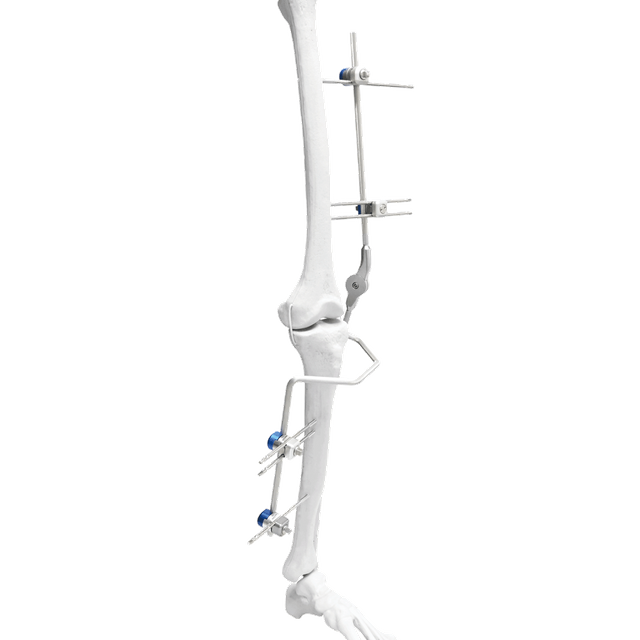 FIjador externo de rodilla (híbrido)