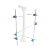 Fijador externo de eje femoral II