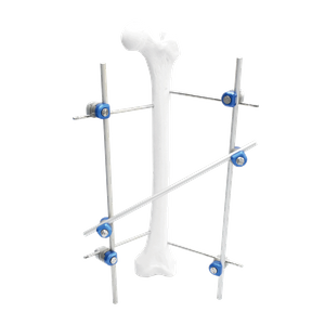 Fijador externo de eje femoral II