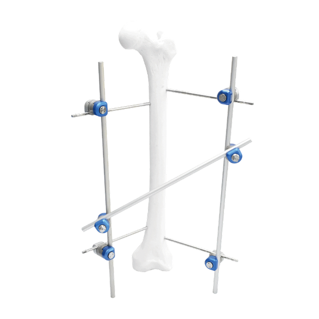 Fijador externo de eje femoral II