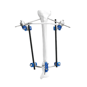 Fijador externo de tibia proximal II