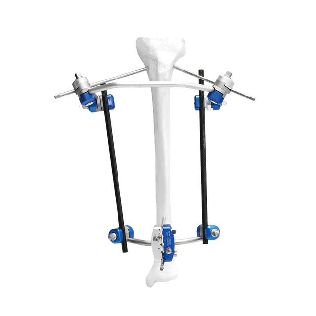 Fijador externo de tibia proximal II