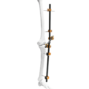 Fijador externo de rodilla Prefix