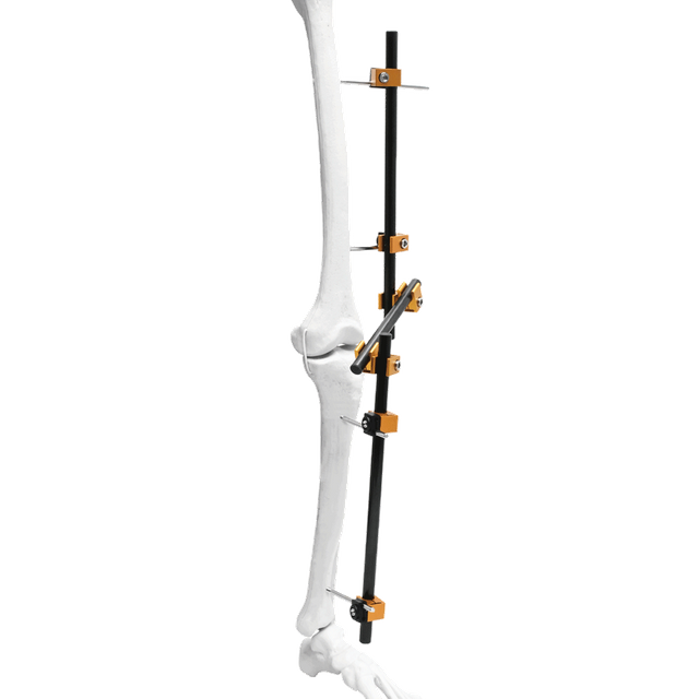 Fijador externo de rodilla Prefix