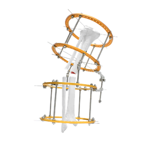Fijador Vara Tibia Ilizarov