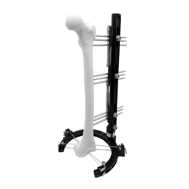 Conjunto de fijador híbrido para reconstrucción