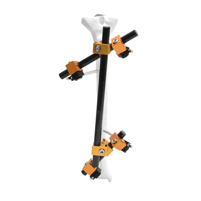 Fijador externo proximal Prefijo I