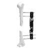 Fijador externo Micromotion pediátrico (tipo recto)