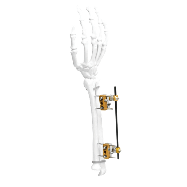 Fijador externo de cúbito y radio