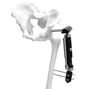 Fijador externo Micromotion de miembros inferiores (tipo T grande)