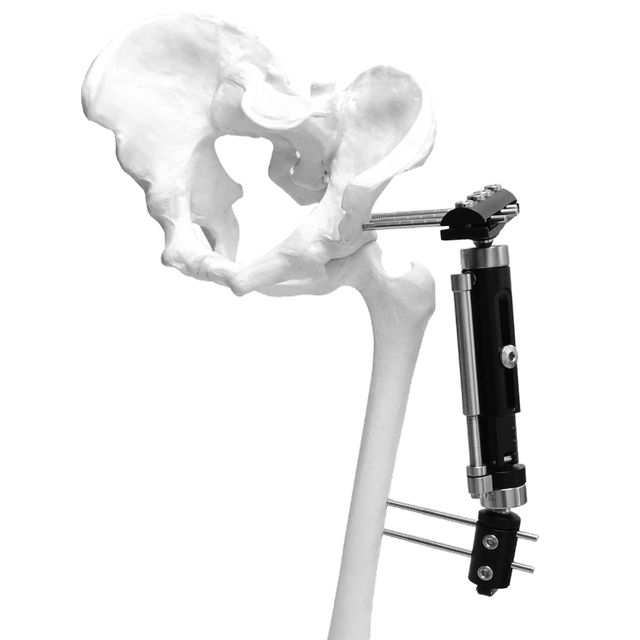 Fijador externo Micromotion de miembros inferiores (tipo T grande)