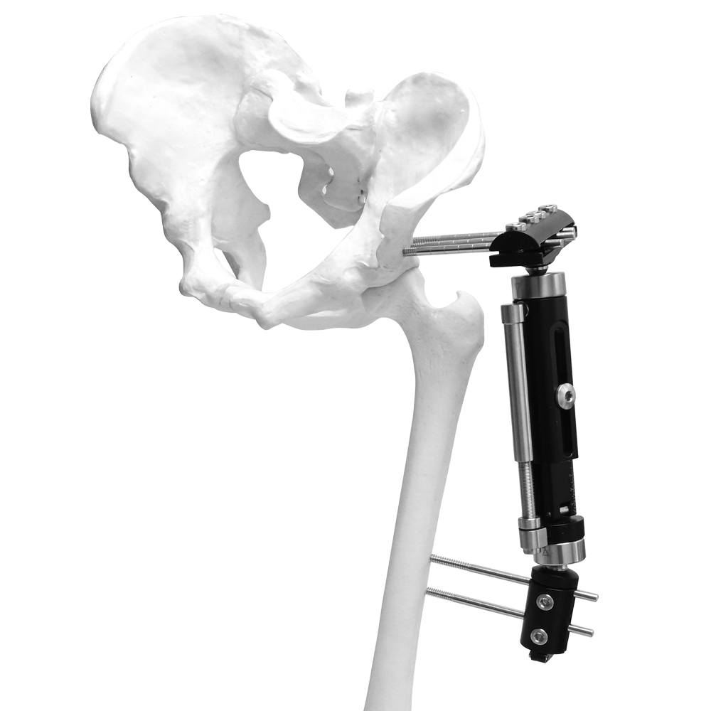 Fijador externo Micromotion de miembros inferiores (tipo T grande)